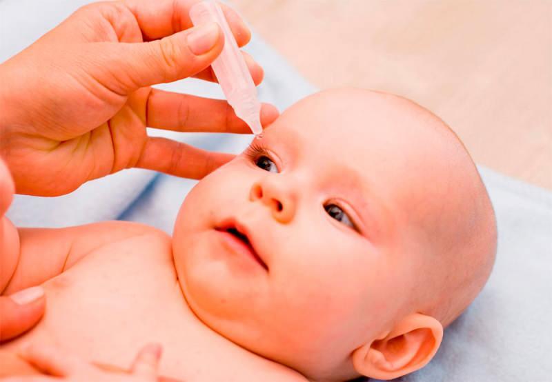 bebeklerde goz kizarikligi ve kasinti nedenleri bebeginizin gozleri sulaniyorsa bebek haberleri