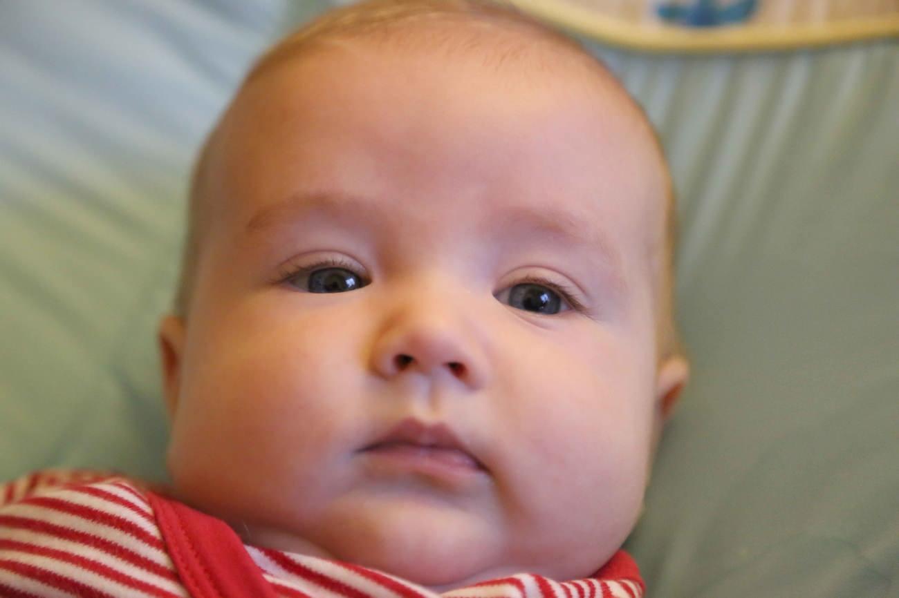 kabakulak bebeklere nadir olarak görülür