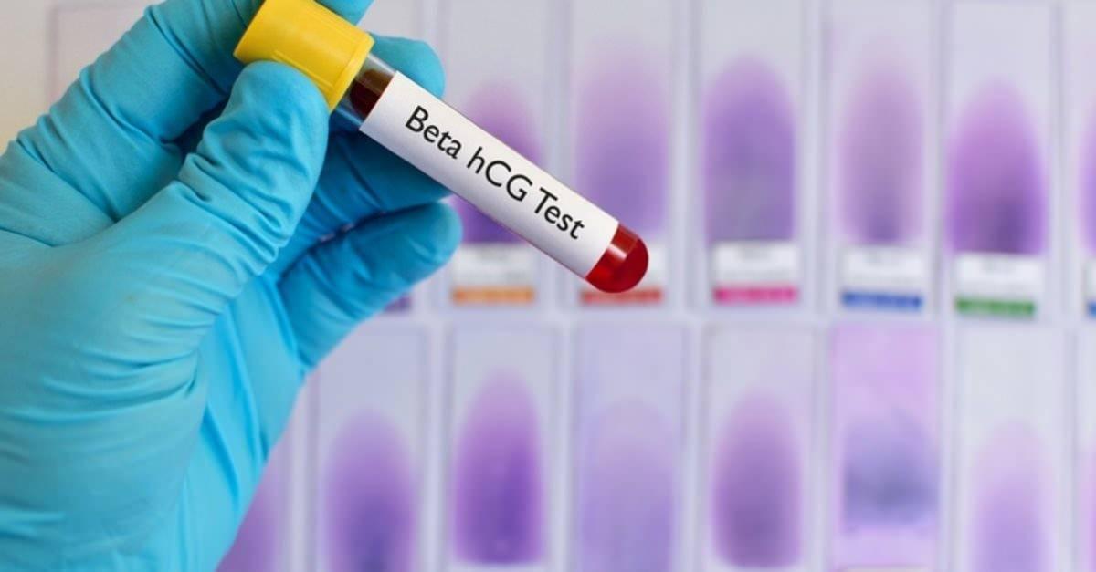 Beta HCG testi nasıl yapılır