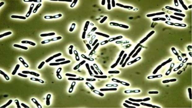 Bacillus cereus bakterisi