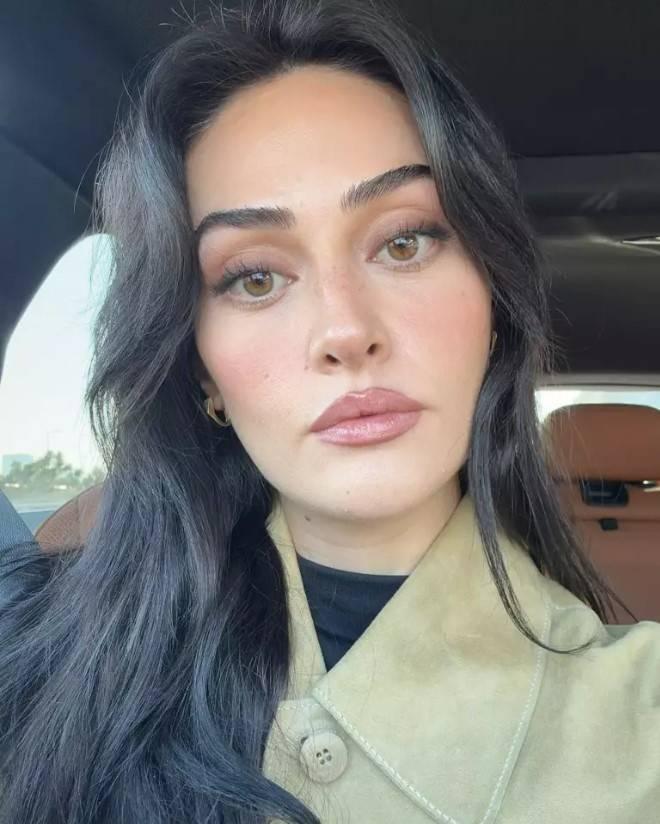 Esra Bilgiç