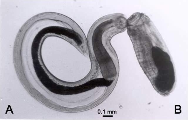 Gnathostoma spinigerum solucanı