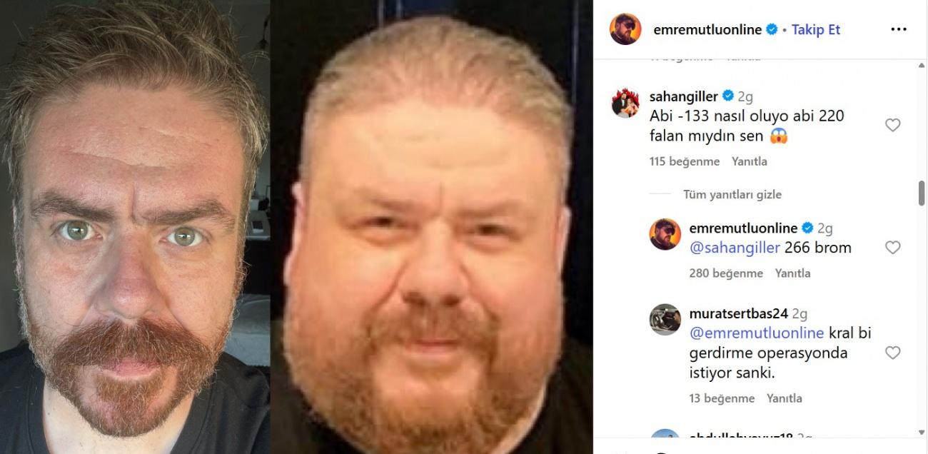 Komedyen Emre Mutlu eski ve yeni hali