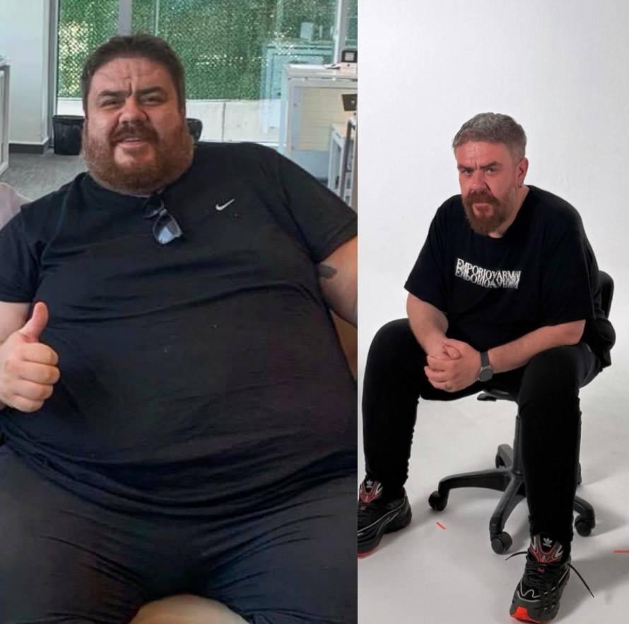 Komedyen Emre Mutlu eski ve yeni hali