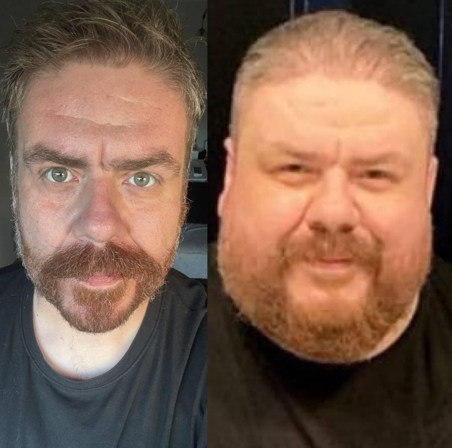 Komedyen Emre Mutlu eski ve yeni hali