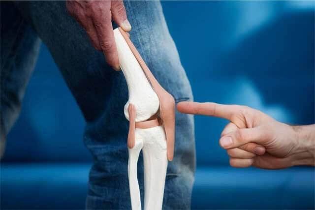 Diz eklemi anatomisi maket üzerinde gösteriliyor