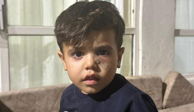 Şanlıurfa'da 4 yaşındaki çocuk oyun oynarken dehşeti yaşadı!