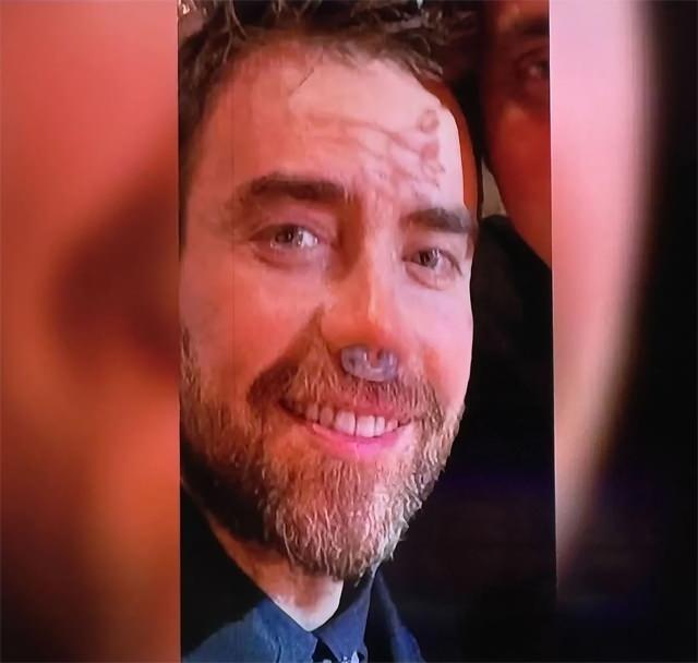 Murat Dalkılıçın yeniden ameliyat olduğunu düşündüren fotoğraf