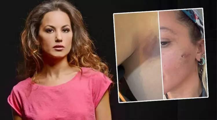 Yıldız Asyalı ve darp iddiası ile paylaştığı fotoğraflar