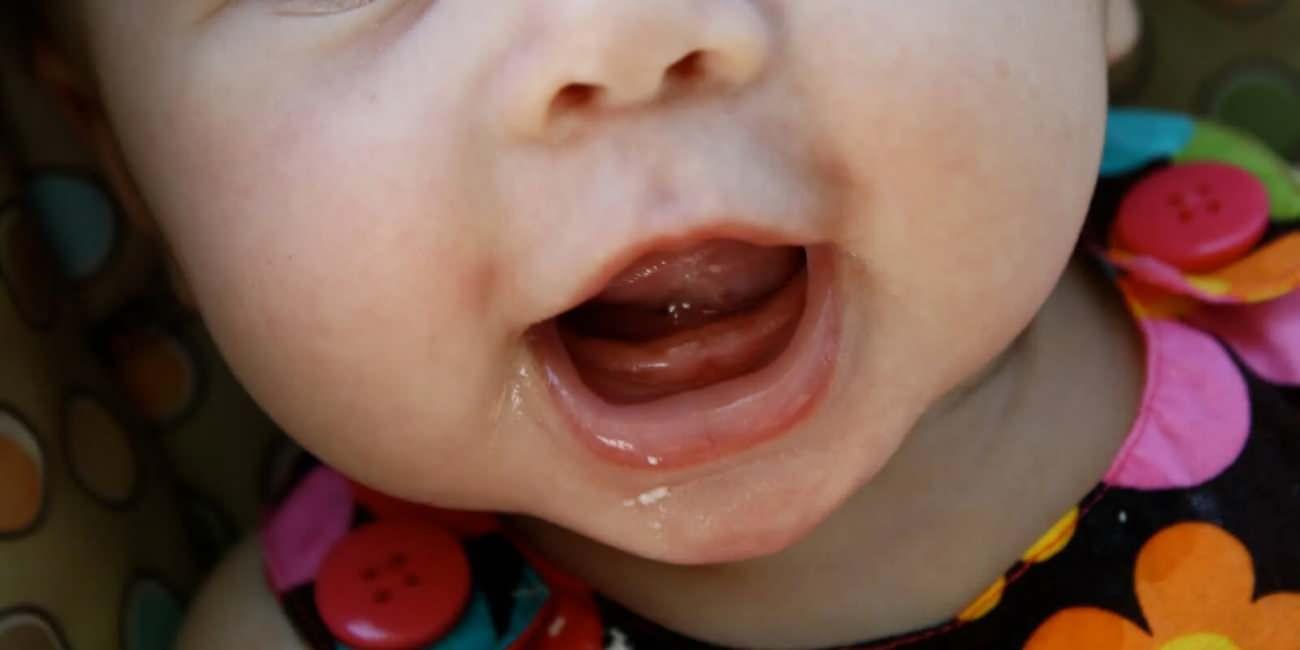 Dişleri yavaş yavaş gelmeye başlayan bir bebek