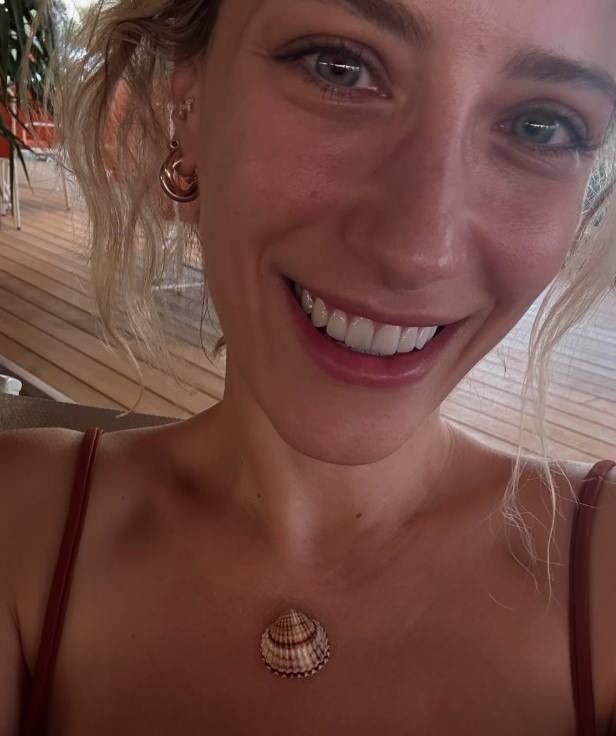 Hazal Kayanın diş estetiği yaptırmış hali