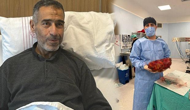 Gaziantep'te 61 yaşındaki adamın 8 kilogramlık b&ouml;breği alındı 