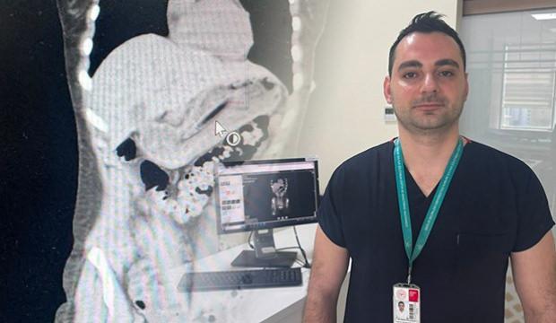 Doktorları şaşkına &ccedil;eviren vaka! Zayıflamak isterken yuttu 