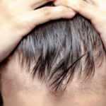  Genç yaşta saç dökülmesi neden olur? Saç dökülmesine karşı doğal çözümler...