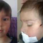 Kastamonu'da 3 yaşındaki çocuğa sokak köpeği saldırdı! Talihsiz çocuk ölümden döndü