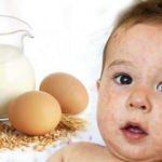 Çocuklarda en çok süt, yumurta ve susam alerjisi görülüyor