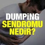 Dumping Sendromu nedir? Dumping Sendromu belirtileri, nedenleri ve ameliyatı…
