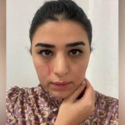 Mersin'de görev başındaki kadın doktora darp; 2 gözaltı