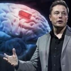 Elon Musk tarih verdi... İlk defa bir insan üzerinde deneyecekler!