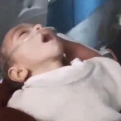 Gazze'de 2 çocuk daha sıvı kaybı ve açlıktan öldü