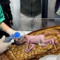  İsrail askerlerince öldürülen Filistinli hamile kadının bebeğini doktorlar kurtardı
