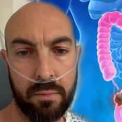 43 yaşında kolon kanseri teşhisi konuldu: 'Görmezden geldim!'