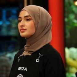 Masterchef Beyza'dan estetik açıklaması! 'Allah böyle yaratmış'