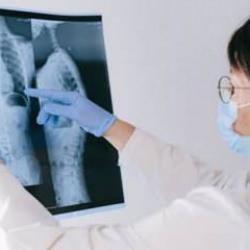 Adını daha önce duymamış olabilirsiniz: Bronşektazi tehlike saçıyor! O belirtilere dikkat…