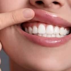 Diş çürüğü deyip geçmeyin! ''Bağırsakta adeta yangın çıkarıyor'' diyerek herkesi uyardı
