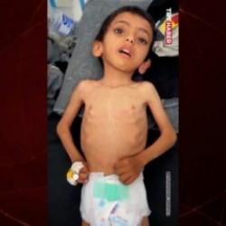 Gazze'de binlerce çocuk açlıktan ölüyor!İşte son örnek Ebu Hüseyin