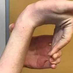Saniyenizi alacak bu test hastalıkları ortaya çıkarıyor! Eğer aşırı esniyorsa…