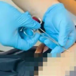 Halsizlik şikayetiyle doktora gitti, karnına yapışanı öğrenince şoke oldu