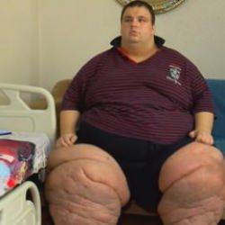 İllet hastalık iki yıl önce başladı! 270 kiloya ulaşan Mehmet, 15 aydır evden çıkamıyor