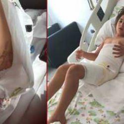 Nevşehir'de düğün faciası! Vücudu donan Elif, 7 operasyon geçirdi
