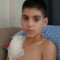 Köpek tarafından parçalanmıştı! Yunus'un sağ kolu felç kaldı