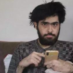 Türkiye'nin konuştuğu ve 3 yıldır tırnaklarını kesmeyen gencin eski hali ortaya çıktı