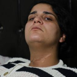 Cips paketini açarken boğazını kesti! Ayrıldığı eşi dehşeti yaşattı: Ölmedin mi sen?