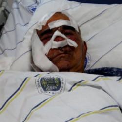 Hayvan otlatırken ayı saldırısına uğradı: Elmacık kemiği koptu! 