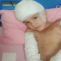 Tunahan’ın davasında emsal karar: Sokak köpeği saldırısında görülmemiş tazminat