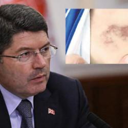 İBB kreşinde çocuğa darp ve istismar! Bakanlardan peş peşe açıklama: 'İhbarlar ciddi'