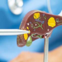 Bu kansere dikkat: Tedavi edilmezse yaşam oranı %15'lere düşüyor!