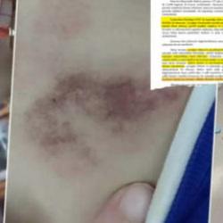 İBB’den medyaya baskı babaya itham! Kreşteki rezaleti mağdur aileye yıktılar