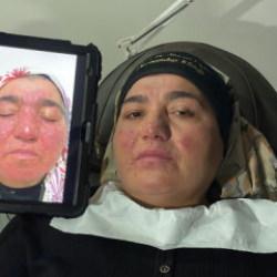 Hastalığı nedeniyle yıllarca evden çıkamayan kadın: Oğlumun düğününe gidemedim