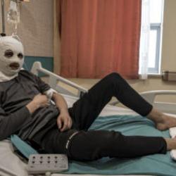 Çakmak gazı faciası! Vücudu yandı