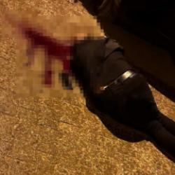 Korkunç olay! Sokakta yürürken başından vuruldu