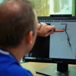 Uzman isim dikkat çekti: 2050'de 3 milyon kişi uzvunu kaybedebilir 