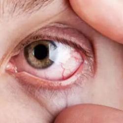 Elinizi bile sürmeyin: Görme kaybına yol açıyor! Acilen bunu yapın