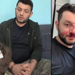 Yalova'da baba ile 14 aylık bebek darbedilmişti! Ailenin 8 yaşındaki çocuğu taşlandı