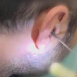 Kayseri'de akılalmaz olay: Kulağına gizlediği uyuşturucuyla yakalandı