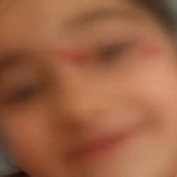 Yer: Eyüpsultan! Okul dönüşü başıboş köpek dehşeti: 6 yaşındaki çocuk hastanelik oldu